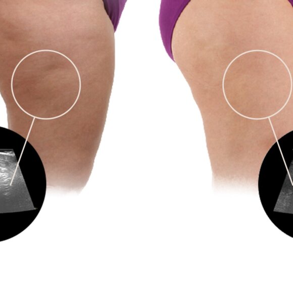 Ashley Black The Mini 2 - Picture 5 of 5